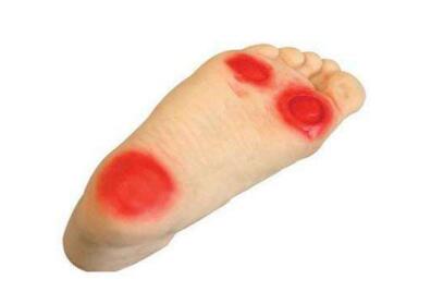 糖尿病足模型_創面基礎護理措施