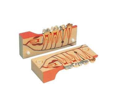 牙分解組織模型